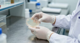Candida Auris